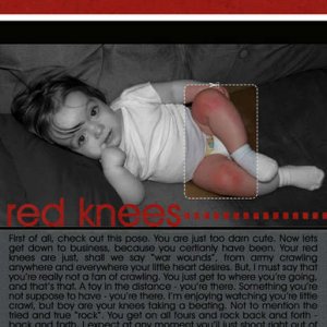 Red Knees